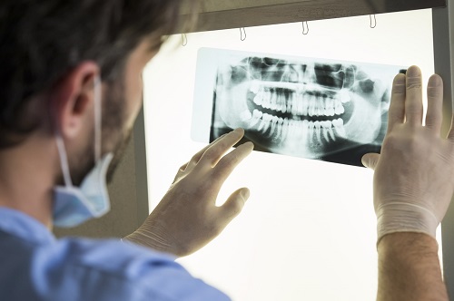 dentist looking at x-ray of mouth