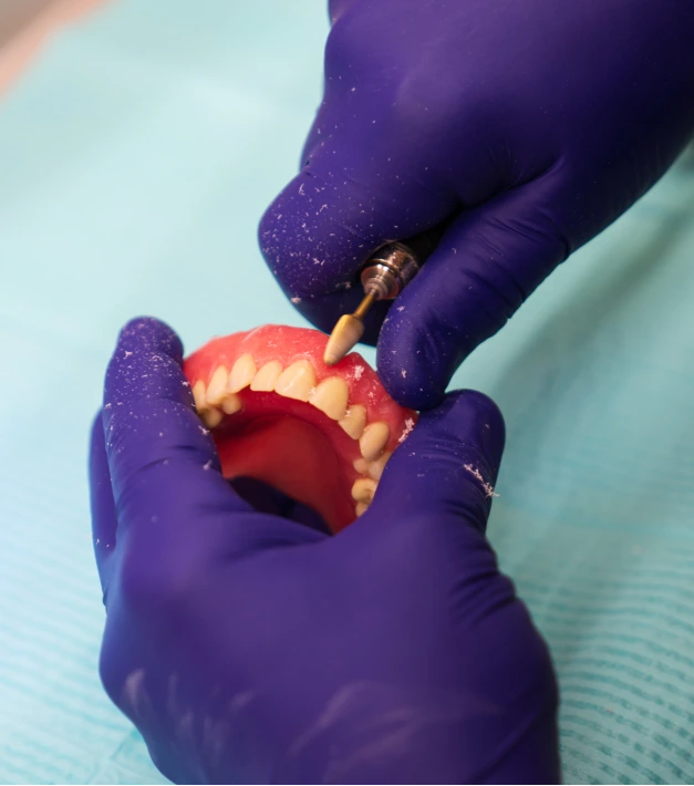 Dentist matching tooth shade for cosmetic treatment