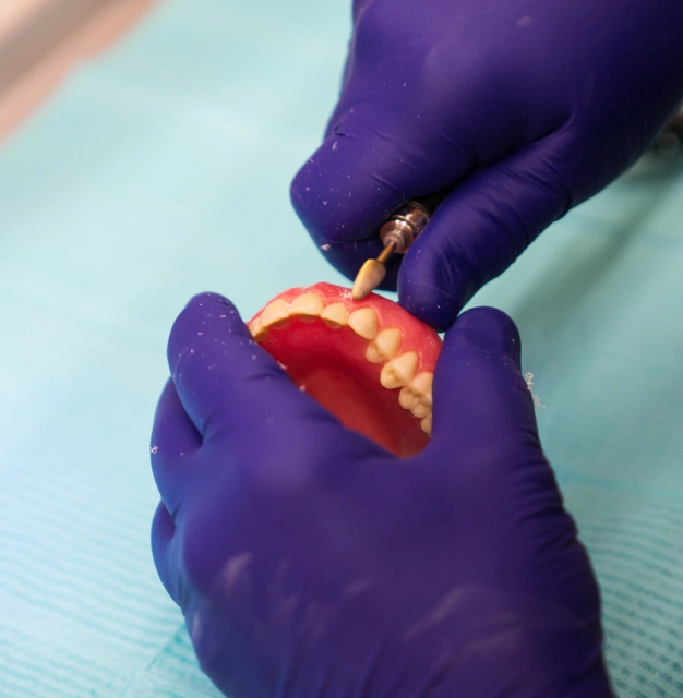 Dental professional performing a professional teeth cleaning