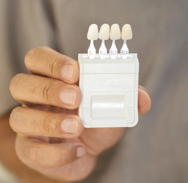 Dental veneers displayed as an option for improving tooth appearance